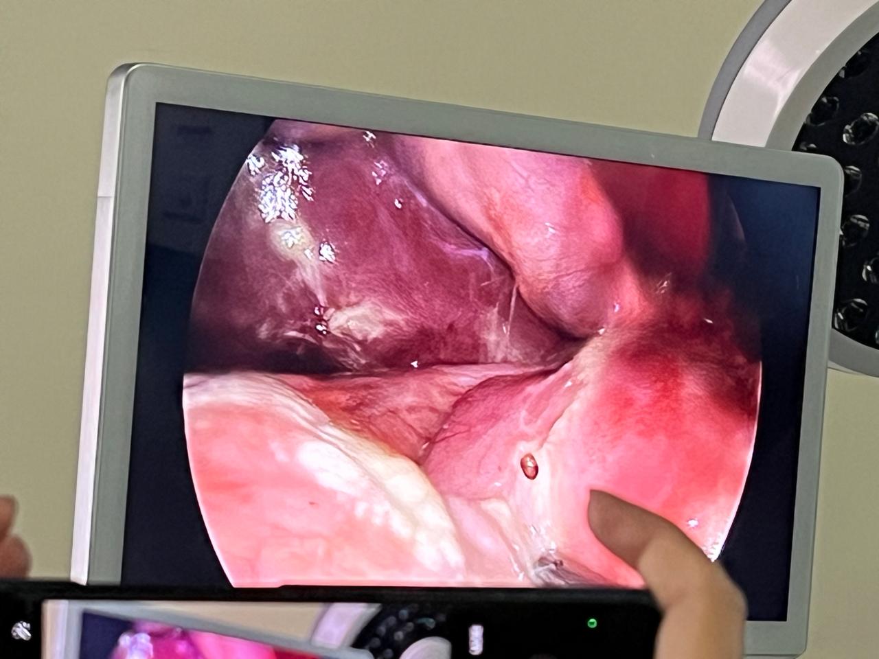 Dr Rahul Rathod General Surgeon and Laparoscopic Surgeon and Coloproctologist in Nagpur 13