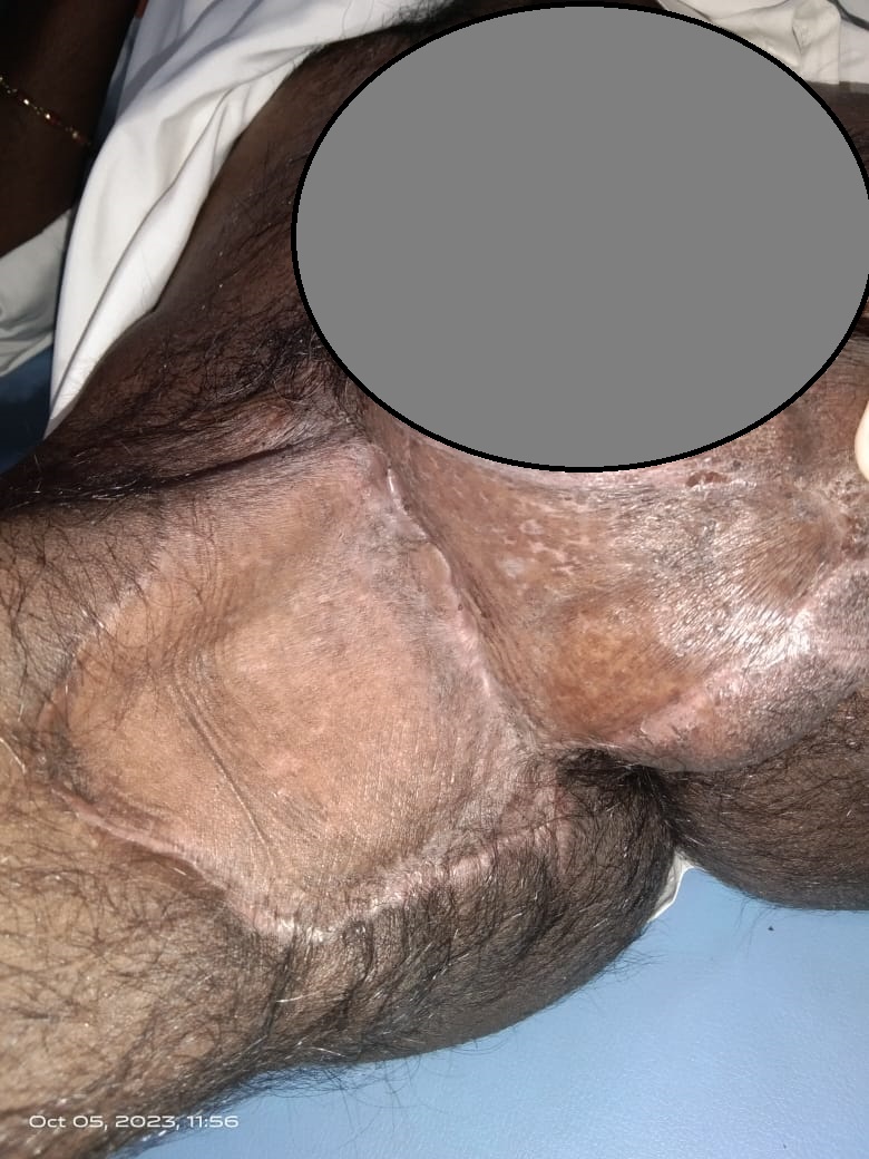 Dr Rahul Rathod General Surgeon and Laparoscopic Surgeon and Coloproctologist in Nagpur 17